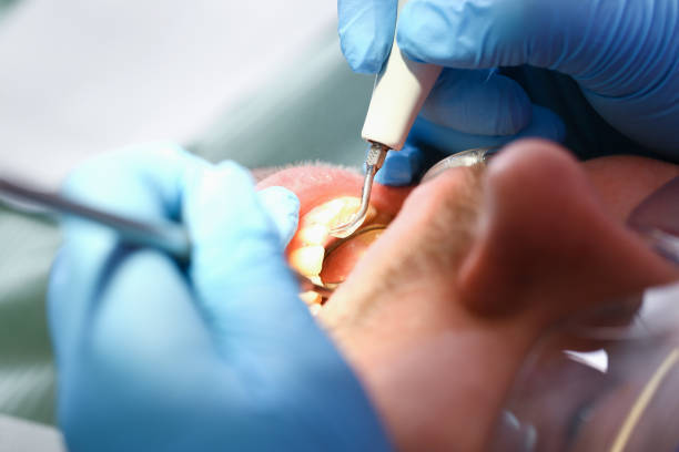 Best Emergency Dental Care for Sports Injuries in Central Gardens, TX
