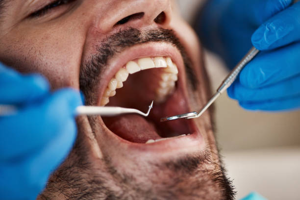 Best Emergency Denture Repair in Central Gardens, TX